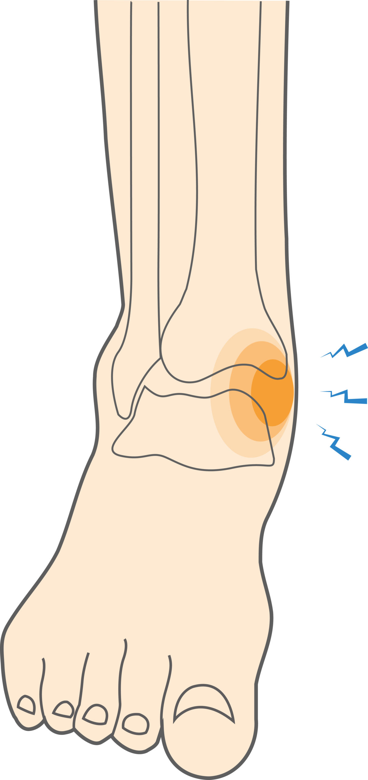 Brunson Expected Back Sunday: One Month After Ankle Sprain Brunson Expected Back Sunday: One Month After Ankle Sprain