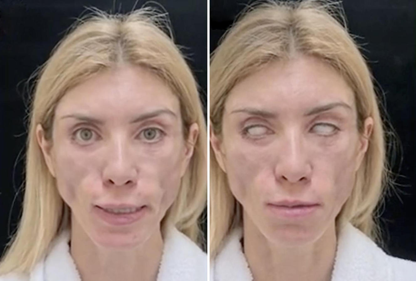 Facelift Gone Wrong? Star's Photoshoot Sparks Debate Among Fans Facelift Gone Wrong? Star's Photoshoot Sparks Debate Among Fans