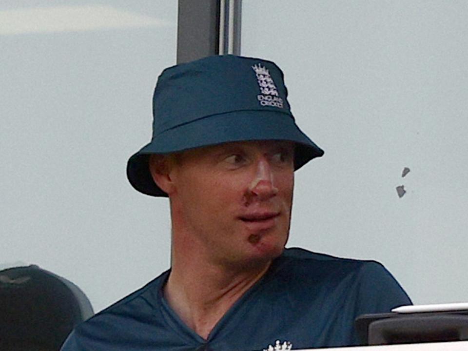Freddie Flintoff Reveals His Face After Injury In New Disney+ Documentary Freddie Flintoff Reveals His Face After Injury In New Disney+ Documentary