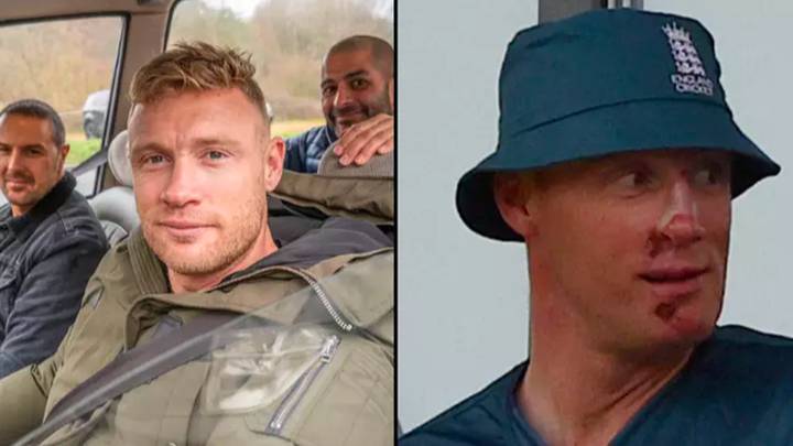 Freddie Flintoff Shows Healed Face After Top Gear Accident Freddie Flintoff Shows Healed Face After Top Gear Accident