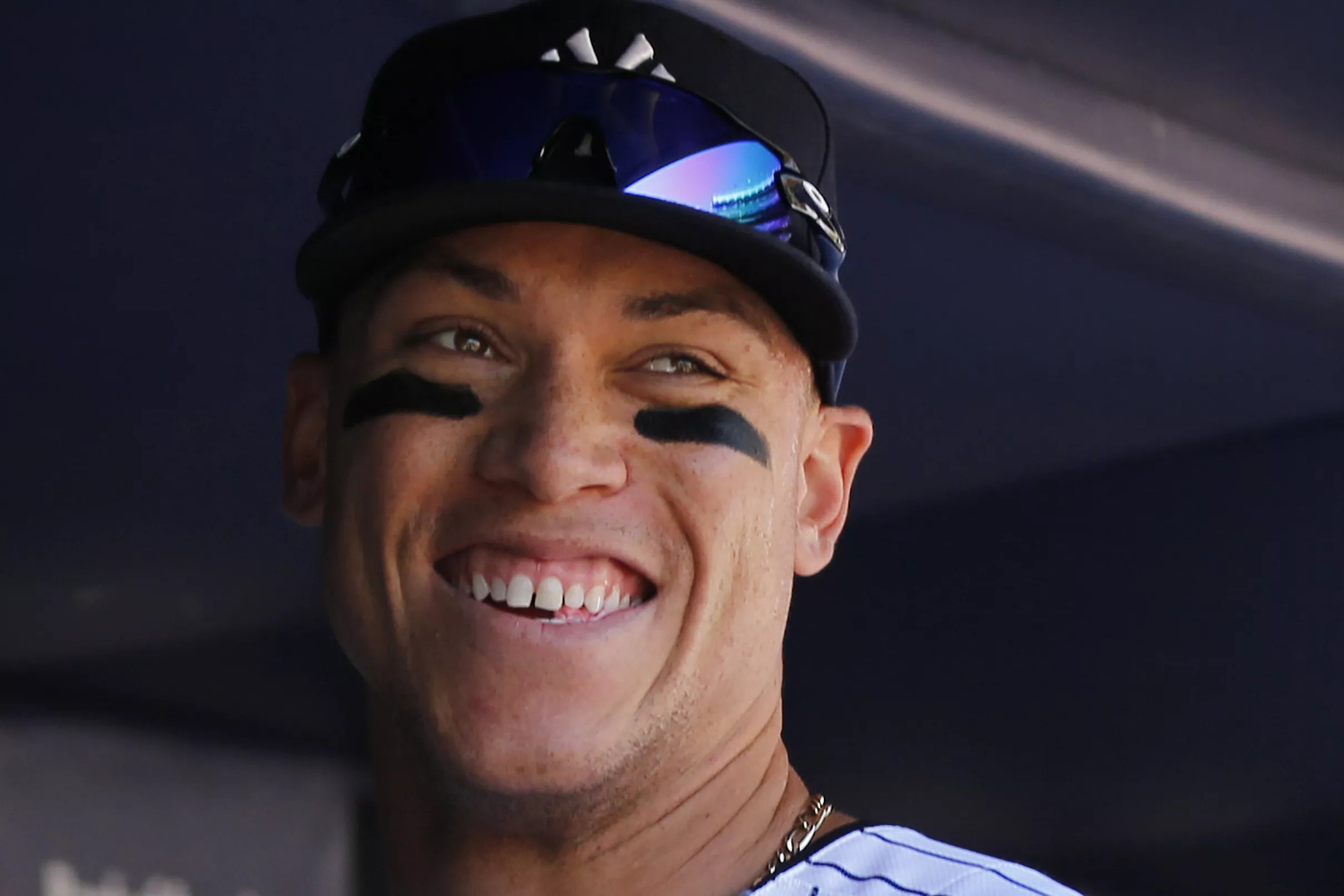 Impact Of Injuries On Yankees Vs. Rays Series: May 2-4 Update Impact Of Injuries On Yankees Vs. Rays Series: May 2-4 Update