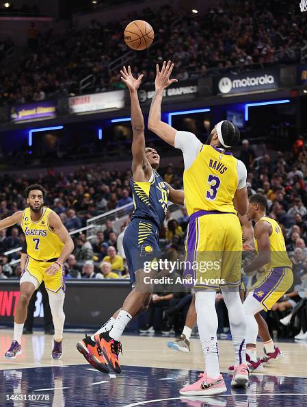 Indiana Pacers Injury News: Mathurin Out Against The Kings?