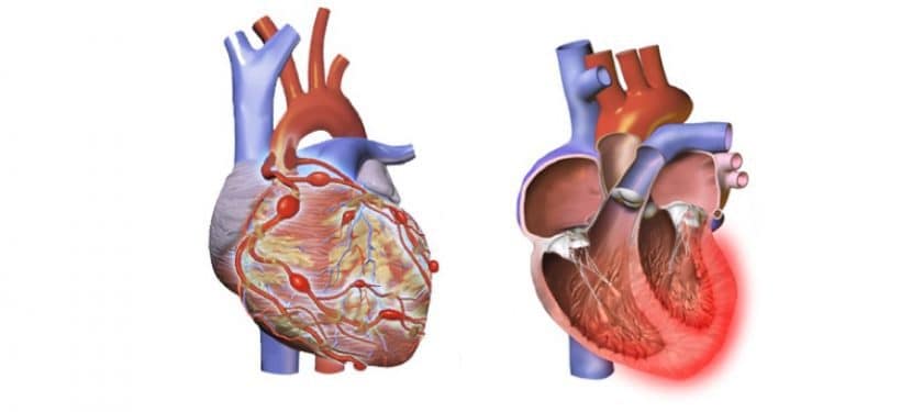 Is A Single, Unknown Respiratory Virus The Cause Of Kawasaki Disease? New Data Suggests A Link Is A Single, Unknown Respiratory Virus The Cause Of Kawasaki Disease? New Data Suggests A Link