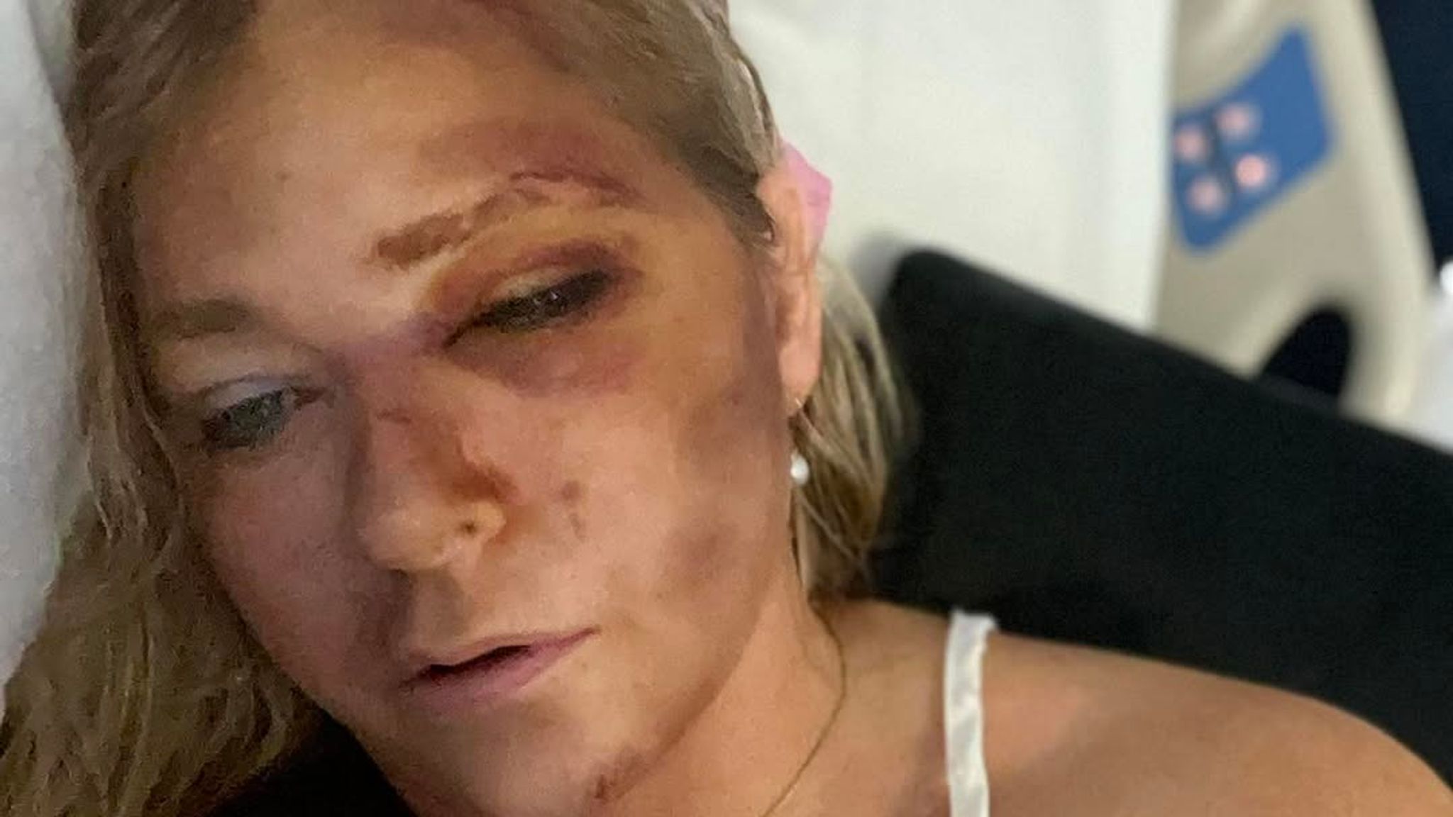 Prince Andrew Accuser's Near-Fatal Car Crash: Four Days To Live? Prince Andrew Accuser's Near-Fatal Car Crash: Four Days To Live?