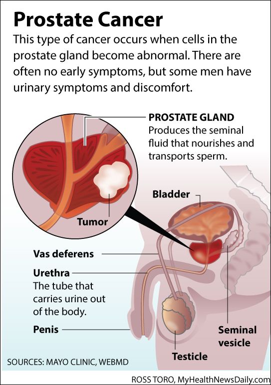 Prostate Cancer Screening: Biden's 2014 Checkup Prostate Cancer Screening: Biden's 2014 Checkup