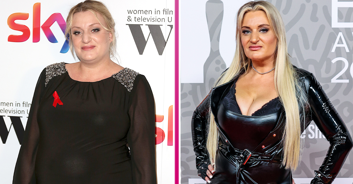 The Reality Of Weight Loss And Lip Fillers: Daisy May Cooper's Perspective The Reality Of Weight Loss And Lip Fillers: Daisy May Cooper's Perspective