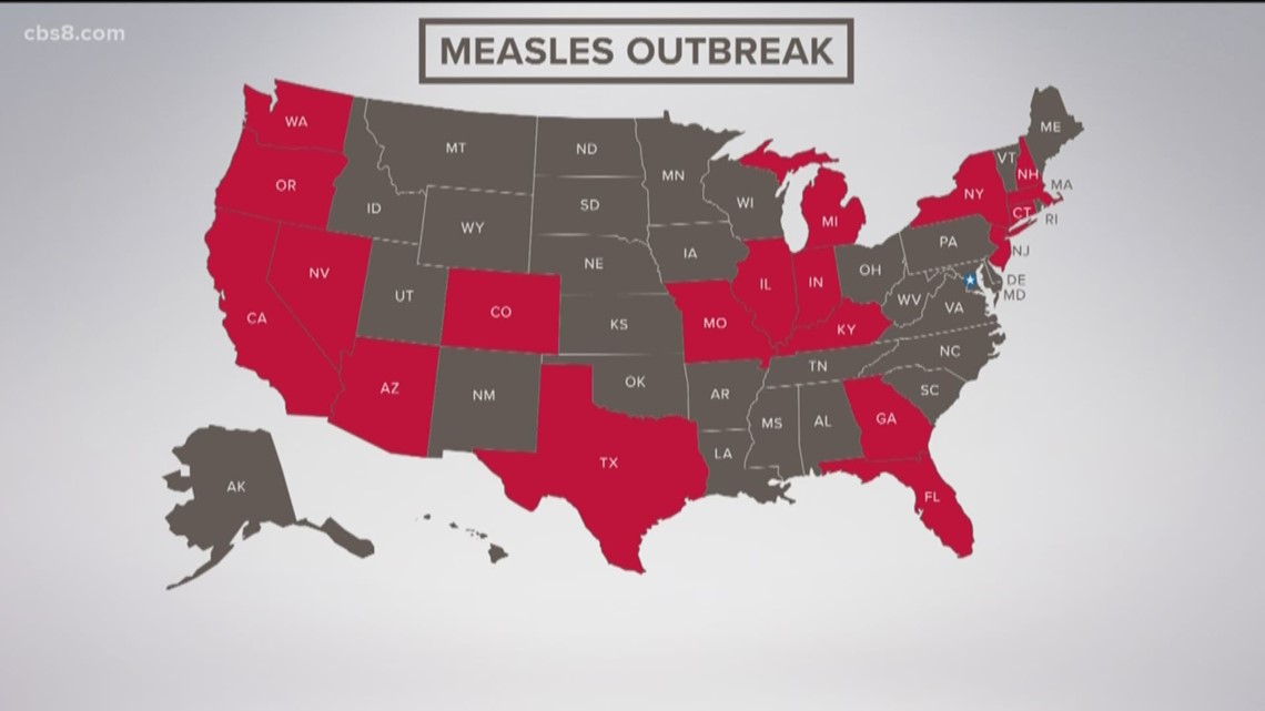 Understanding The Measles Outbreak: Tracking Cases Across The United States Understanding The Measles Outbreak: Tracking Cases Across The United States