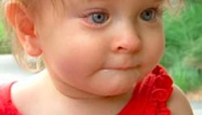 What Is Bilateral Anophthalmia? A Comprehensive Guide For Parents And Professionals What Is Bilateral Anophthalmia? A Comprehensive Guide For Parents And Professionals
